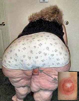 Eh, j'ai un truc au cul ?