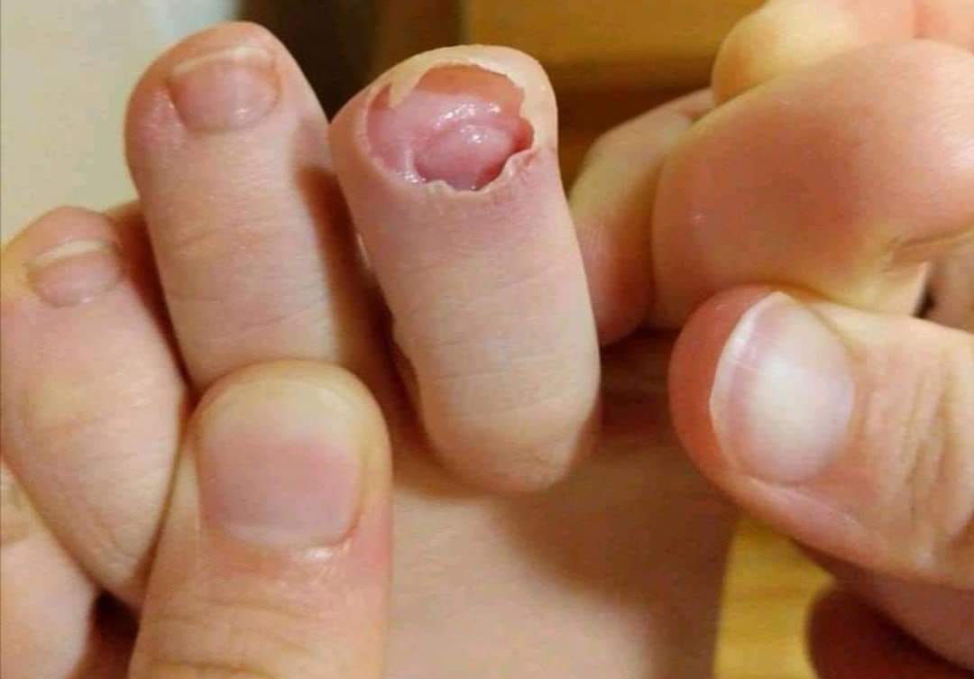 Je lance l’étron dans la mare  