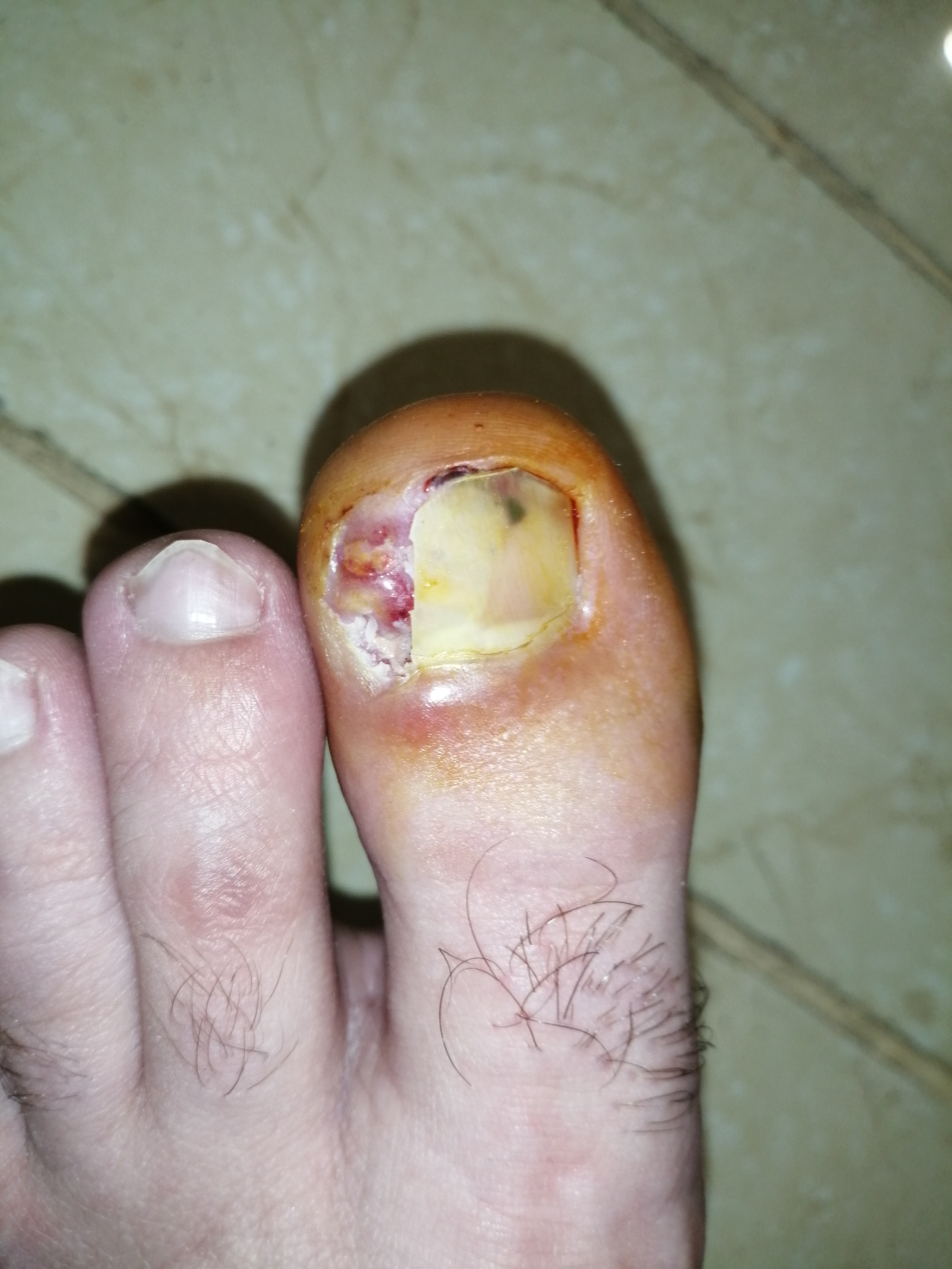 Fétichiste des pieds #2