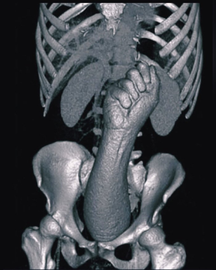 Quand le communisme vous la met bien profond.