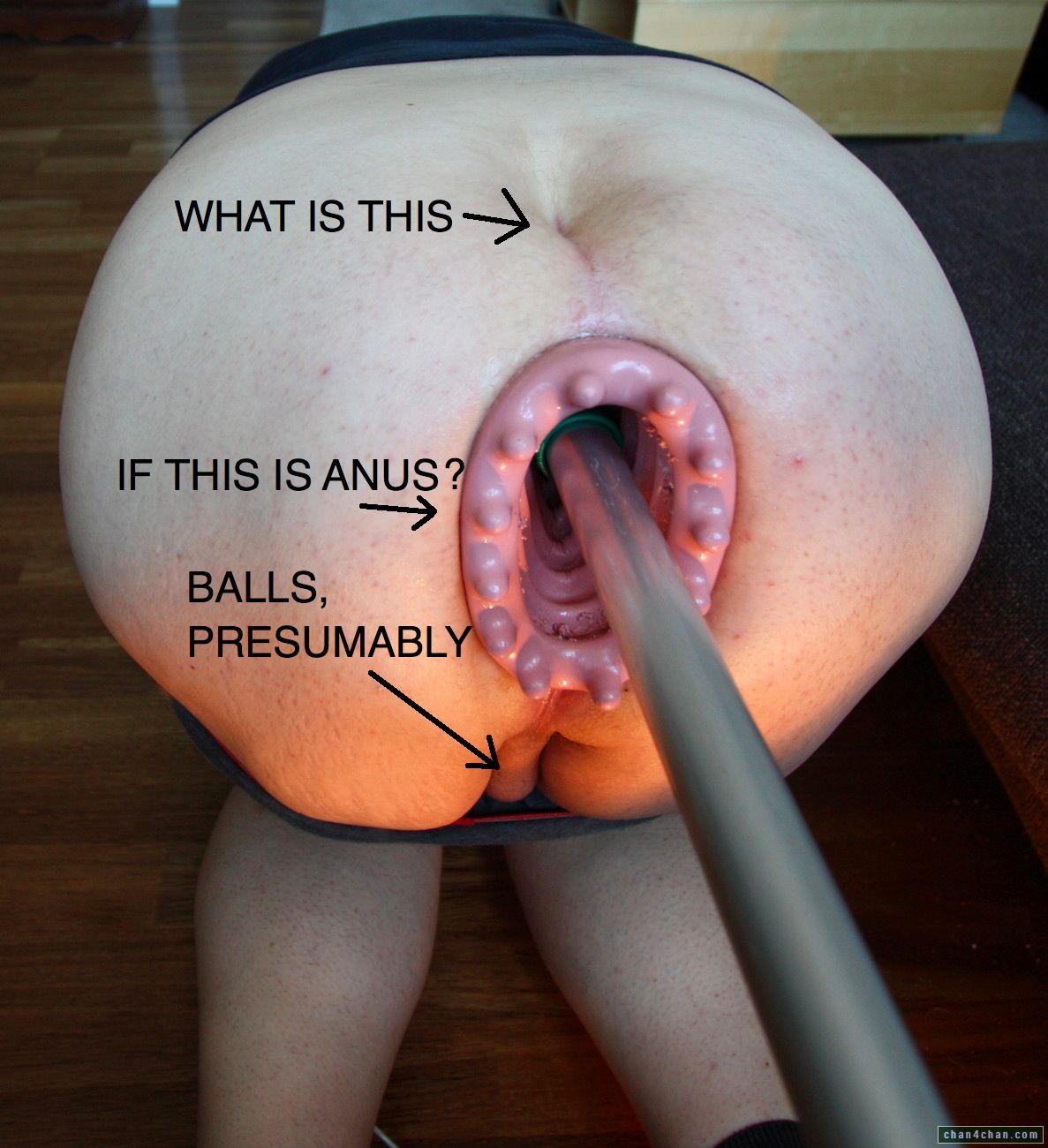 Anus. 