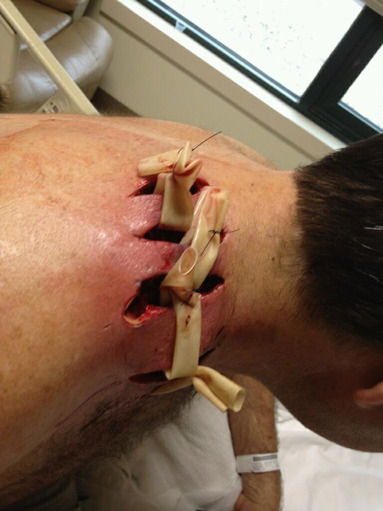 Les victimes de Wolverine, parlons en