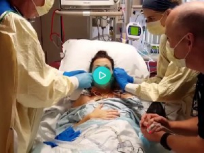 Elle prend sa première respiration sans assistance après une greffe de poumon.