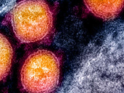 Covid-19 et « anticorps facilitants » : les vaccins aggravent-ils les infections au coronavirus ?
