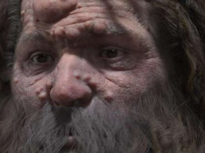 Le visage de l’homme de Cro-Magnon était couvert d’excroissances