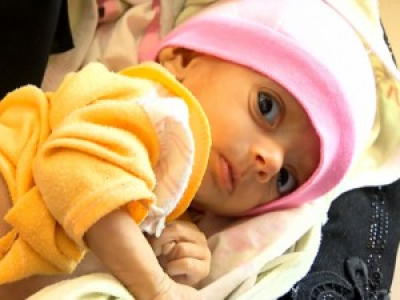 Au Yémen, les enfants meurent dans l'indifférence la plus totale.