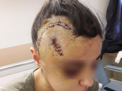 A Marseille, des policiers fracassent le crâne d’une jeune femme à terre