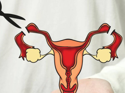 Avortement aux Etats-Unis : les stérilisations en forte hausse